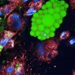 In vitro xərçəng modeli şiş hüceyrələrinin qan dövranına necə daxil olduğunu göstərir