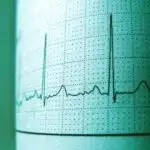 Sonsuz keçmişdən gələcəyə: Simulyasiya qara dəlik məkanında cazibə dalğasının tam səyahətini izləyir