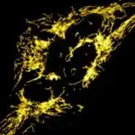 Uzunmüddətli tədqiqat orta yaş damar sağlamlığını sonrakı demans riski ilə əlaqələndirir