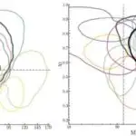 Yuxu pozğunluqları və eşitmə itkisi ümumi bioloji mexanizmləri bölüşür, araşdırma tapır