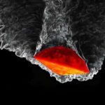 Yeni kəşf edilmiş mexanizm dərin beyin stimulyasiyasının terapevtik təsirlərinə kömək edə bilər