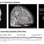 Virusların daxil olma yollarının və fırıldaqçı molekulların kəşfi sarı qızdırma və ensefalitin qarşısını ala bilər.