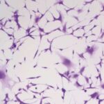 Bədən yağından sümüyə qədər təcrübə sınıqların “zərif” təmiri üçün ümid verir