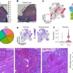 Qaraciyər xəstəliyi ilə əlaqəli alternativ tatlandırıcı sorbitol