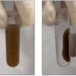 Zalunfiban ST-yüksək infarktlarda erkən faydalar göstərir