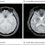 Şərqi Afrika Rift araşdırması bəzi qitələr üçün ayrılmanın niyə çətin olduğunu üzə çıxarır