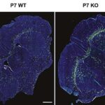 DNT forması və sərtliyi gen ifadəsinin əsas oyunçularını tənzimləyir