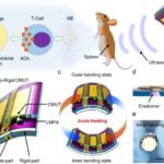 Alzheimer risk kalkulyatoru təhlükəni simptomlar başlamazdan əvvəl müəyyən edə bilər