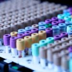 Təbii gün işığı diabet xəstələrinə qan şəkəri səviyyəsini necə yaxşılaşdıra bilər