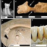 Xalq təbabətində istifadə edilən bitki iltihab əleyhinə anti-artritik təsirə malikdir, tədqiqat təsdiqləyir