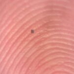 Mədə xərçəngi öz-özünə böyüməyi necə öyrənir