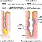 Mədə xərçəngi öz-özünə böyüməyi necə öyrənir