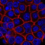 “Əbədi kimyəvi maddələrlə” bağlı sağlamlığa təsirlər milyardlarla iqtisadi itkilərlə əlaqələndirilir