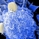 Deformasiya olunan linza tək pikselli mikroskopiyada görüntü aberrasiyalarının real vaxt rejimində korreksiyasına imkan verir