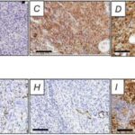 İşıq antibiotiklərə davamlı patogendə virulentliyi necə azaldır
