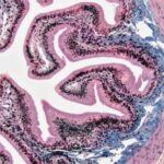 Edisonun 1879-cu ildəki lampa təcrübələri təsadüfən qrafen istehsal etmiş ola bilər