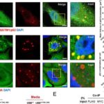 Kvant cazibə qüvvəsinin beş ölçüdə mənalandırılması