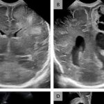 Arıqlamaq üçün aralıqlı orucun arxasındakı dəlillər təbliğatla üst-üstə düşmür