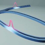 Probiotiklər sizin üçün işləyəcəkmi? Modellər bağırsaq metabolizmasını xəritələşdirərək uğuru proqnozlaşdırır