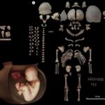 Tüpürcək nümunələri və süni intellektdən istifadə edərək yaşlanma ilə əlaqəli zehni geriləmənin proqnozlaşdırılması