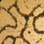 Bakterial patogenlər filament iskelelərindən istifadə edərək antibiotiklərə davamlı “bunkerlər” qururlar