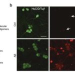Kök hüceyrə terapiyası yeni klinik sınaqlarda yaşlanma ilə əlaqəli zəifliyi aradan qaldırmaq üçün ümidverici nəticələr göstərir