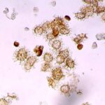 Foundation AI modeli çoxsaylı beyin xəstəliklərini proqnozlaşdırmaq üçün MRT məlumatlarından istifadə edir