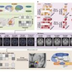 Beyin müayinələri nazik beyin qabığı bölgələri ilə daha yüksək psixopatik xüsusiyyətlər arasında əlaqəni ortaya qoyur