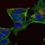 Stress altındakı hüceyrələr: Kimyaterapiya dərmanı RNT-yə necə zərər verir