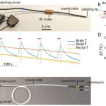 Dəqiq radio dalğaları beyin xəstəliklərinin qarşısını almağa kömək edə bilər