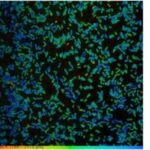 Müxtəlif C-terminal variasiyaları sağlamlıq və xəstəlikdə zülal sabitliyini yenidən təyin edir