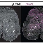 Beyin bölgələri arasındakı əlaqələr antidepresanların effektivliyini proqnozlaşdıra bilər