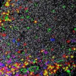 Yaradıcı terapiya DEHB beynini necə yenidən canlandırmağa kömək edə bilər