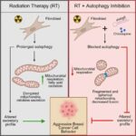 Norveçli “Oslo xəstəsi” qardaşı tərəfindən bağışlanan nadir kök hüceyrə transplantasiyasından sonra HİV remissiyasına çatdı