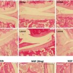 Kiçik bir diod yaddaş və emal əlavə etməklə görüntü sensorlarını kiçildə bilər