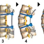 2 yaşlı uşağın beyninin anatomik cəhətdən dəqiq rəqəmsal əkizləri autizmlə əlaqəli neyron imzalarını aşkar edib
