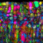 Modul nanorobot öz-özünə yığılır, xərçəng hüceyrələrini hədəf alır və canlılığı azaldır
