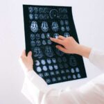 Qan analizi Alzheimer xəstəliyinin simptomlarının inkişaf riskini on il əvvələ qədər proqnozlaşdıra bilər